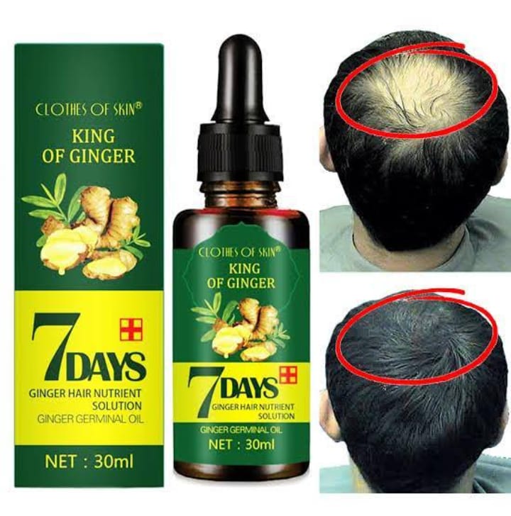 7 Day Hair Growth Serum, 30ML Herbal Formula Hair Care Hair Nutrition Liquid Hair Growth